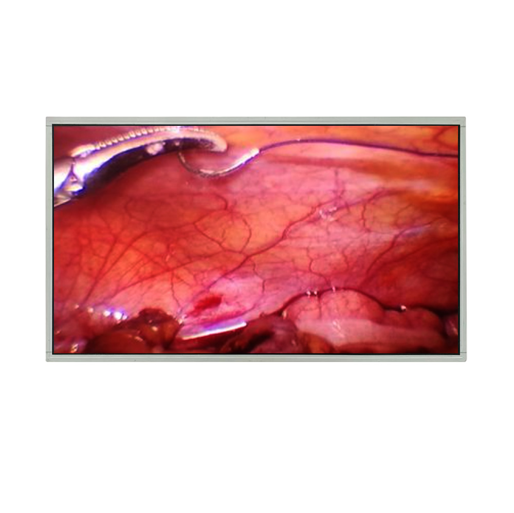 32 inch 3840x2160 4K 51PIN EDP 500nits UHD Medical LCD Module
